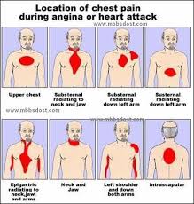 10 13 03 Upper Chest Only Not Sharp And Sob Last Few Days Nursing Care Cardiac Nursing Nursing Care Plan