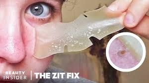 The device i tried definitely exfoliated my skin and made it glowier, while helping to remove some of the dead skin and buildup that was making my pores look enlarged. Overnight Pore Strips Absorb Excess Sebum The Zit Fix Youtube