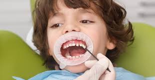 The fluoride varnish sticks to the teeth until brushed away the next day, however, the benefits of the fluoride will last for several months. Controlled Protection For Milk Teeth With Fluoride Varnish