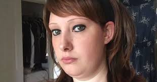 Young mum has rare condition which causes her to tear her eyebrows off and  pull out her hair