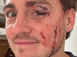 Wallabies vs British and Irish Lions tour 2025: James O'Connor, Australia  return, Instagram photo after tough training session