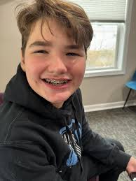 Luke Boan got braces today and his physical for Volleyball. Things are  starting to get better for him. Here we go again, Another beautiful  transformation. Before/during/after!