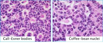 Fa Repro Pathology B Flashcards Quizlet