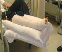 How To Prepare For Orthopaedic Foot Or Ankle Surgery Part Iii Ankle Surgery Ankle Surgery Recovery Foot Surgery Recovery