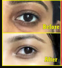 Makeup and tools you'll need. Makeup Hacks Know How To Cover Dark Circles Under The Eyes Newstrack English 1