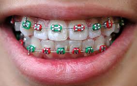 Macam mana cara nak buat permohonan baru bpn 2.0 secara online? Pakai Braces Akhirnya