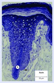 The following tests are used to identify merkel cell carcinoma, and to determine its stage (how far the disease has. Semi Thin Section From The Fingertip Of A Rhesus Monkey Merkel Cells Download Scientific Diagram