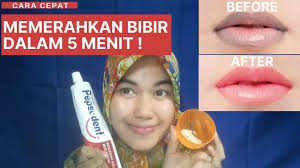 Bahkan jika anda memiliki bibir yang berwarna hitam rasa percaya diri akan berkurang. Cara Memerahkan Bibir Hitam Secara Alami Dan Permanen Dengan Cepat Youtube