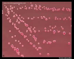 Image result for yersinia fotos