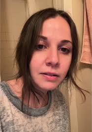 and I keep doing it. #fyp #skin #wtf #iykyk #fireplace #winter #psa #safety  #dermatologist #skincare #themoreyouknow #storytime #humor  #toastedskinsyndrome