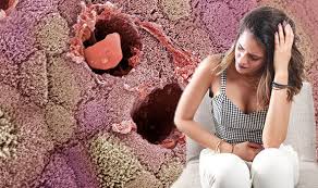 Cancer facts for women, breast cancer signs and symptoms, signs and symptoms of colorectal cancer, american cancer md anderson cancer center: Bowel Cancer Symptoms The Three Main Signs Of Bowel Cancer You Must Be Aware Of Express Co Uk