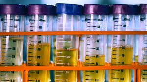 Selbst in supermärkten sind sie zu finden: Ard Documentary Doping Top Secret Guilty Rbb24
