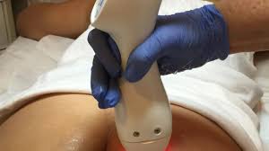 Start your journey to a lighter anus - try our bleach kit