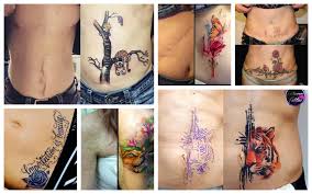Many meanings are behind each and every tattoo. Scar Cover Up Tattoos That Will Amaze You All For Fashion Design