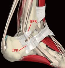 Extension of the knee joint through the medial patellar retinaculum is vital to such movements as walking medial and lateral retinaculum knee. Cosm Peroneal Tendon Surgery