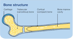 Beating bone cancer depends on many factors, including as the type of bone cancer you have, how soon you received treatment, and whether the. Secondary Bone Cancer Cancer Council Victoria