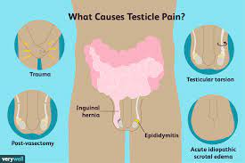 Testicular Pain: Causes, Diagnosis, and Treatment