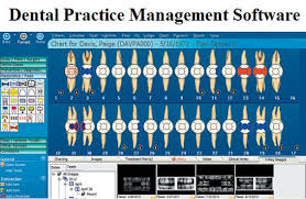 Dental Practice Management Software Market To Boom Usd 4 3
