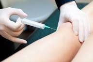 Intra-Articular Injections to Treat Joint Disorders