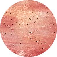 Acari del legno, come eliminarli: Punture Da Parassiti Dei Tarli Curare E Prevenire Le Dermatiti Da Tarli