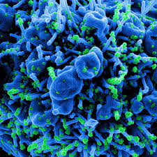 Mutated variant was first documented in december in nelson mandela bay, sa public health england has found at least 105 cases caused by the variant in uk 2pwvpz3qnfhcsm