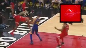 Chicago bulls guard kris dunn could reportedly miss the rest of the season with his right knee the former no. Kris Dunn S Teeth Left A Mark On The Bulls Court After His Terrifying Fall Article Bardown