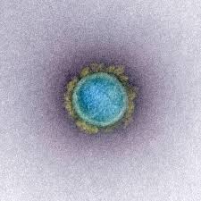 Fueled by the delta variant, daily coronavirus case counts in new york city have begun climbing in recent days, even as the city seems determined to turn the page on the pandemic. Corona Infektionen Mit Delta Variante Entdeckt Kreis Giessen Aussert Sich Zu Clustern Giessen