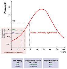 High Sensitivity Troponin Testing Rebel Em Emergency