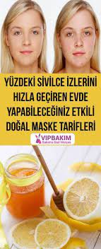 Sivilce Izleri Nasil Gecer Sivilce Lekeleri Icin Dogal Yontemler Vipbakim Sivilce Izi Dogal Cilt Bakimi Dogal