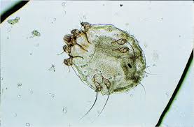 Permethrin is the drug of choice for the treatment of scabies. Permethrin Treatment In Scabies Infestation Importance Of The Correct Formulation Abstract Europe Pmc