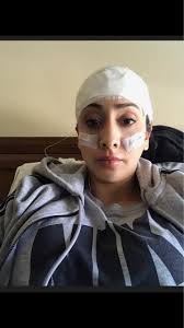 Living with Lupus Pt 2. — The Perio Pocket by: Perio Princess