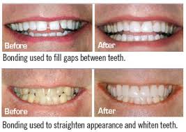 By opting for spot treatment, you automatically. Md360 Online