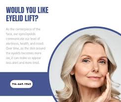 Fresh Eyelid Surgery Anaheim