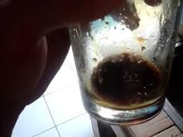 Berikut ini beberapa penyebab batuk yang tak kunjung sembuh. 5 Menit Langsung Sembuh Obat Batuk Berdahak Kaskus