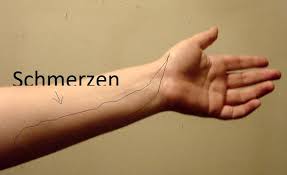 Schmerzen Im Unterarm Gesundheit Sport Arzt