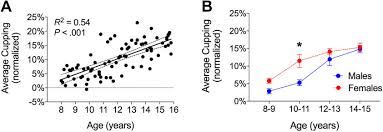 Postnatal Skeletal Growth Is Driven By The Epiphyseal Stem Cell Niche:  Potential Implications To Pediatrics | Pediatric Research