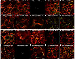 We did not find results for: Association Of Six Yfp Myosin Xi Tail Fusions With Mobile Plant Cell Organelles Bmc Plant Biology Full Text