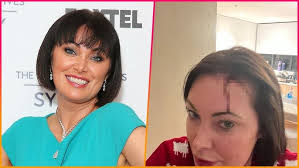 Real Housewives of Sydney star Lisa Oldfield sparks concern when she  reveals a bleeding head