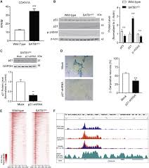 Kumpulan soal psikotes online contoh soal psikotes konsistensi. Loss Of Satb1 Induces P21 Dependent Cellular Senescence In Post Mitotic Dopaminergic Neurons Sciencedirect