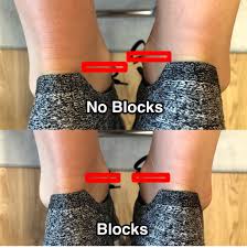 Image result for Functional Leg Length Discrepancy