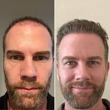 THE BEST 10 CRYOTHERAPY near WILTON, CT