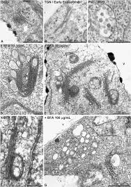 Maybe you would like to learn more about one of these? Organelle Identification And Characterization In Plant Cells Using A Combinational Approach Of Confocal Immunofluorescence And Electron Microscope Springerlink
