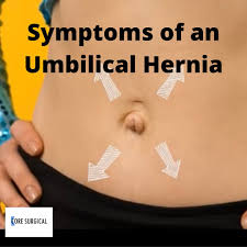 Image result for stomach hernia symptoms