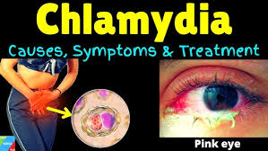 Image result for chlamydia symptoms