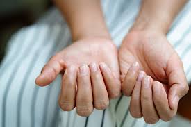 How To Heal Painful Cracked Fingertips An Overview