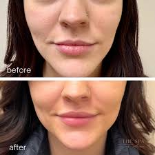 Profil for The Spa at Atrium