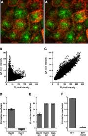 Mobile microsite search term search. A Practical Guide To Evaluating Colocalization In Biological Microscopy American Journal Of Physiology Cell Physiology
