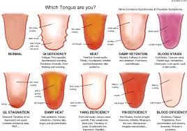 tongue diagnosis chart employed by acumedic centre london