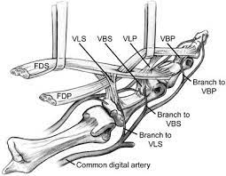 There are 2 tendons acting on each finger to bend or flex the finger. Jersey Finger Hand Orthobullets