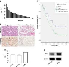TdIF1: a putative oncogene in NSCLC tumor progression | Signal Transduction  and Targeted Therapy